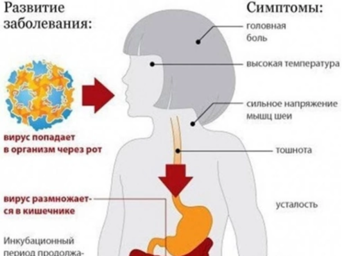 ПРОФИЛАКТИКА ПОЛИОМИЕЛИТА. .